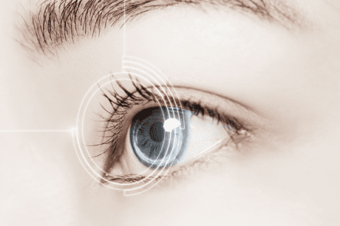 LASIK (Laser Eye Surgery) – DE