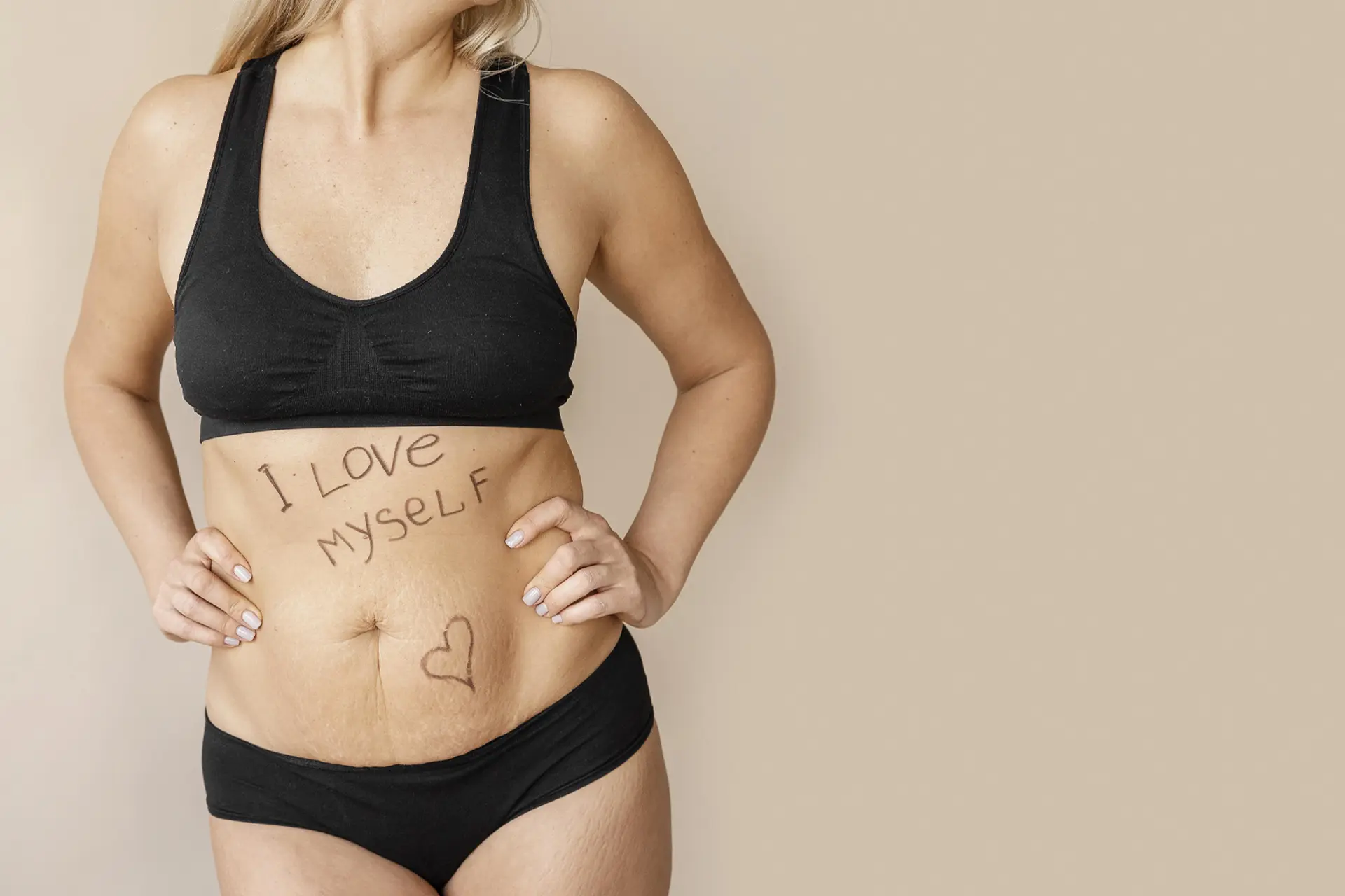 Tummy Tuck (3)