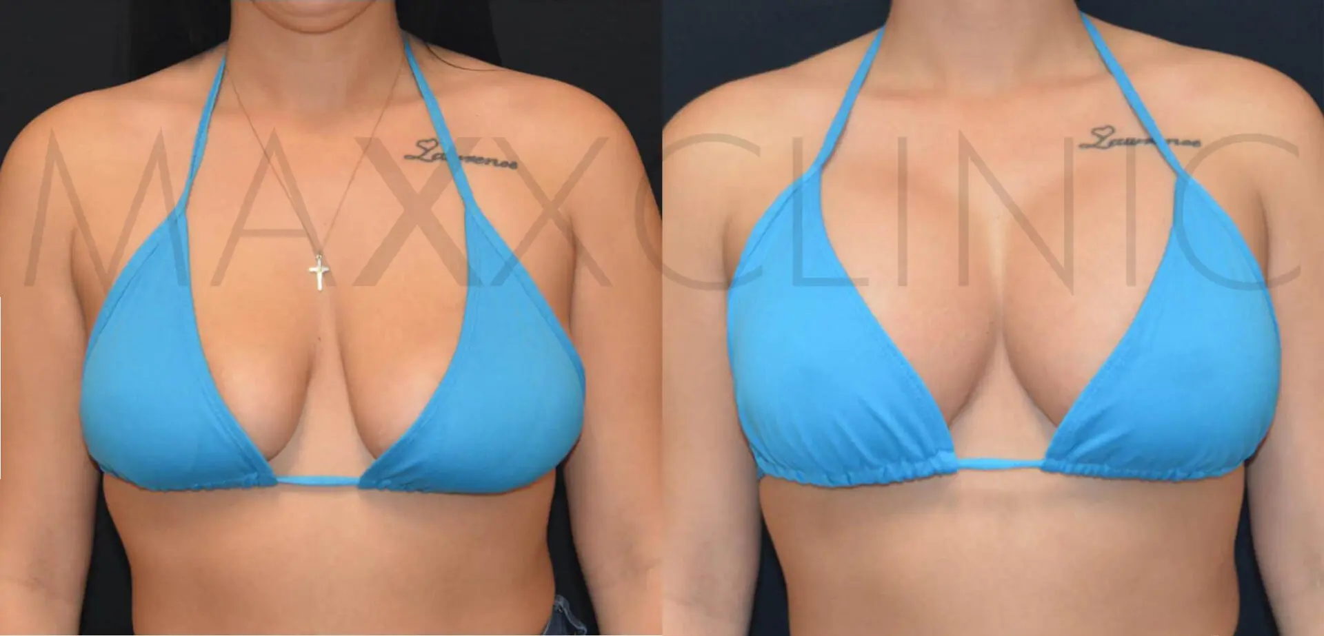 beforeafter-logo